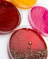 Piastre batteri resistenza